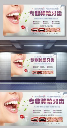 专业种植牙齿宣传展板